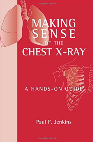 Cubierta de la obra Making sense of the chest x-ray: a hands-on guide